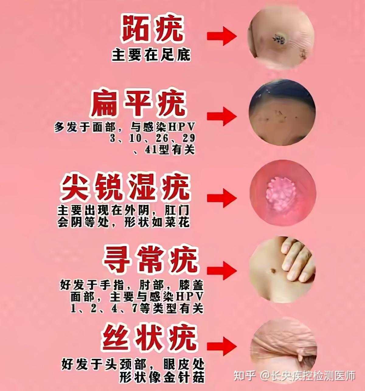 CSGO科技键盘对选手的影响：精准操作与胜负的关键