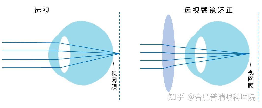 探索暗黑不朽：自动挂机深度解析与实战指南