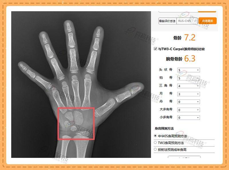 暗区突围辅助脚本：游戏神器