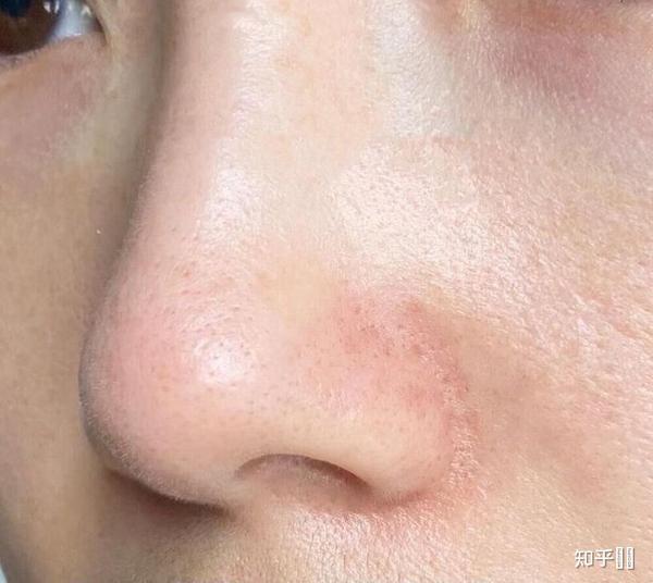 蛋仔派对辅助外挂：深度解析与使用策略