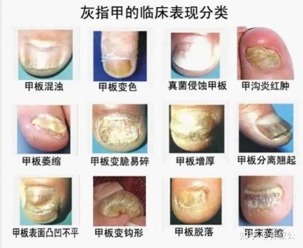 方舟飞升指令发布