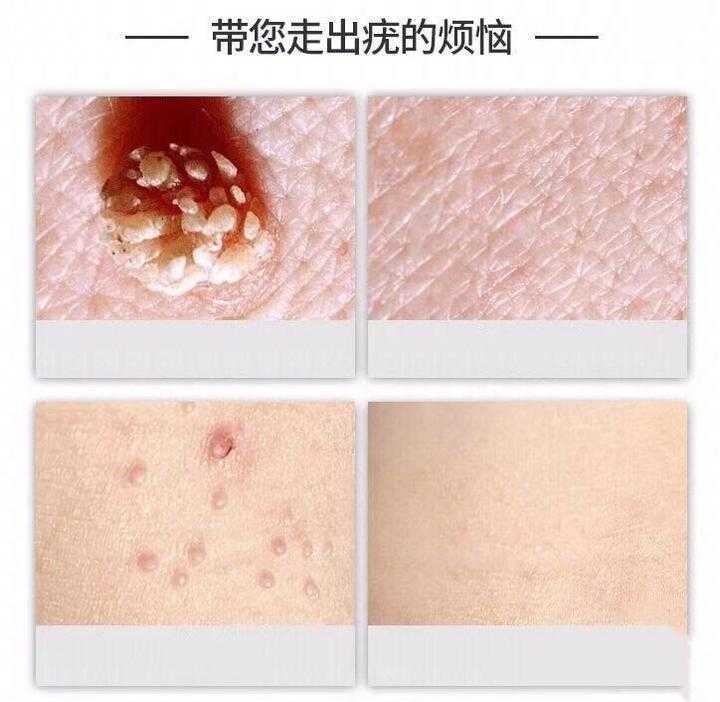 永劫无间keo科技深度解析与应用探索