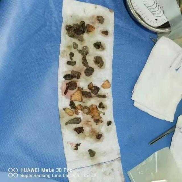 云应用如何颠覆未来？5大关键点全解析！