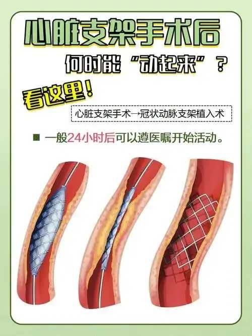 药物支架术后血管内皮修复机制研究