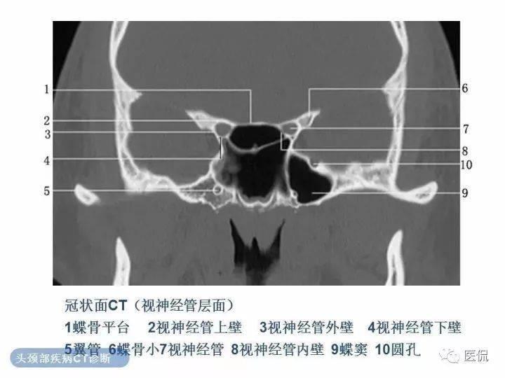 pubg国际服稳定透视卡盟，地铁逃生攻略与技巧