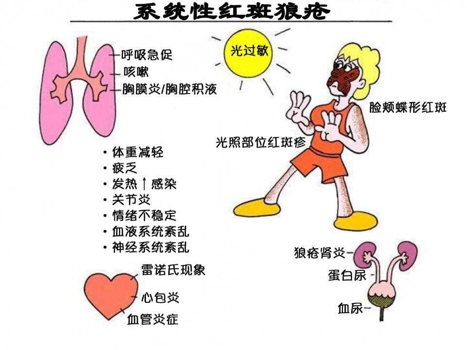 高能英雄首发送Q币5，限时福利，立即参与