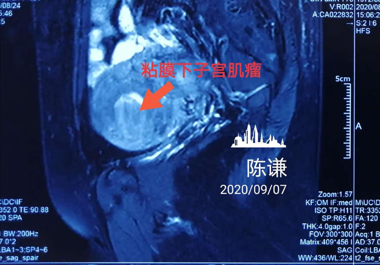 暗区突围PC科技辅助全攻略解析  暗区 突围 PC 科技 辅助 全攻 略解 析 第1张