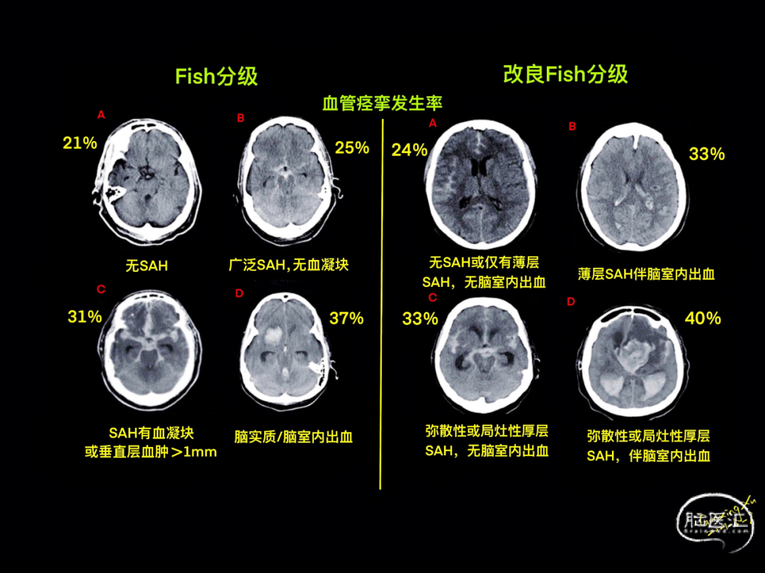 QQ炫舞直播平台最新活动攻略资讯