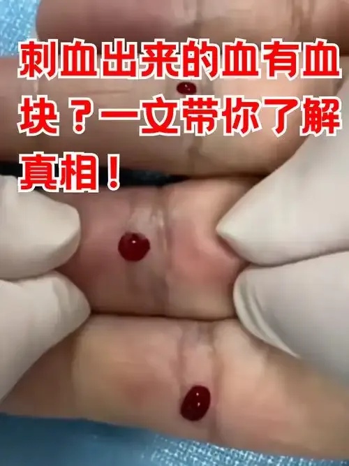 暗黑战场生死操控术锁血终极秘术曝光