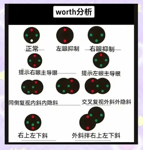 主导眼和辅助眼的区别:详解与科普