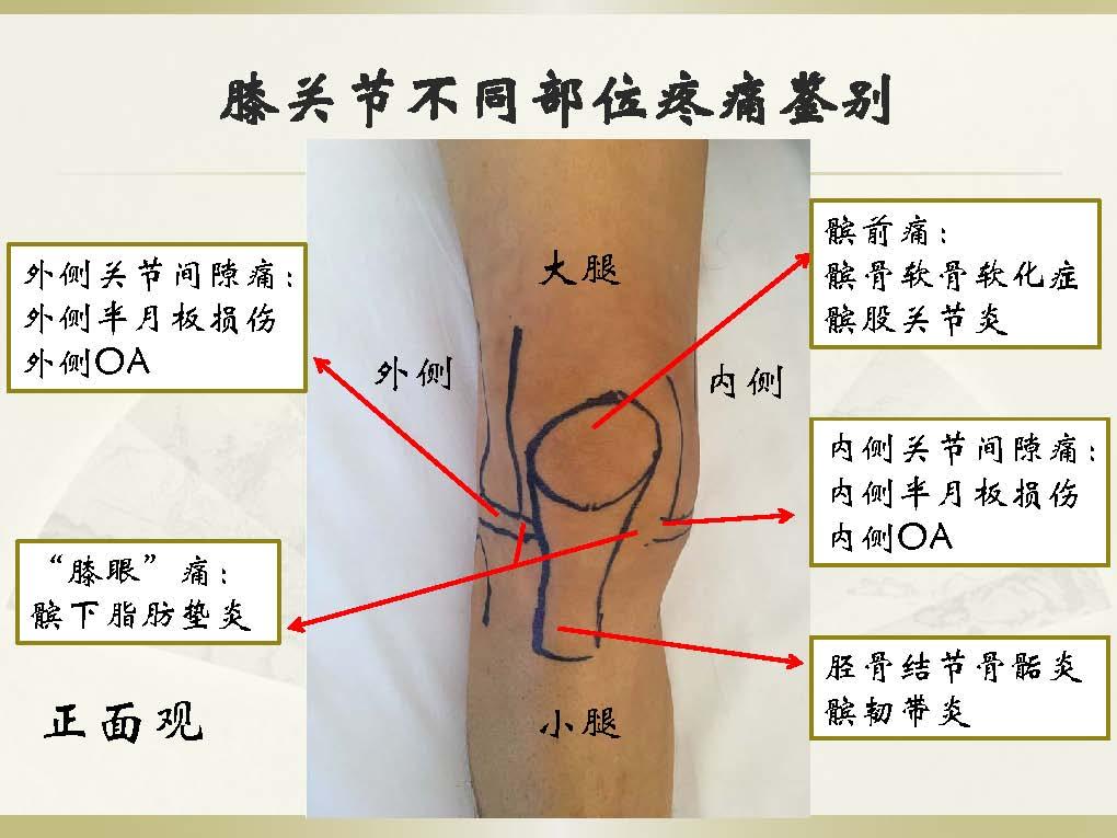 诅咒之岛破解版无限金币获取指南
