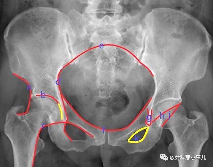 王牌战争直装挂使用方法