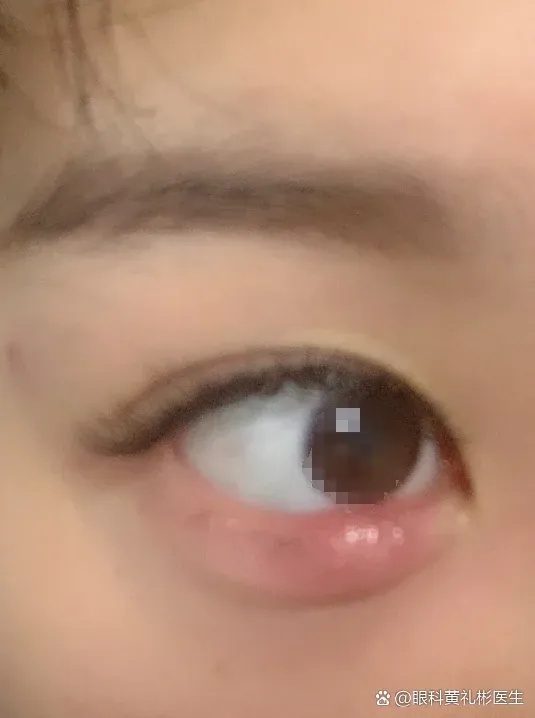 萤火突击辅助器介绍!它到底隐藏了什么秘密?
