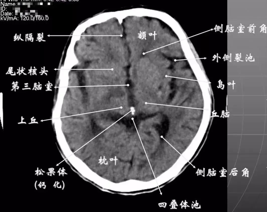 生死狙击免费辅助器开挂快速上分攻略