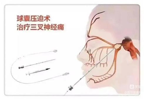 超自然行动辅助插件包:功能解析与使用指南