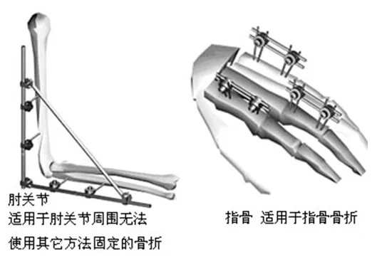 电竞台球直装版:体验指南