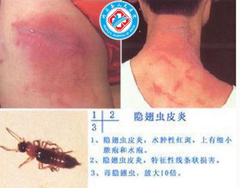 荒野乱斗怎么开挂教程